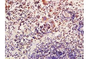 Formalin-fixed and paraffin embedded mouse spleen labeled with Anti-ATG16L Polyclonal Antibody, Unconjugated  at 1:200 followed by conjugation to the secondary antibody and DAB staining (ATG16L1 anticorps  (AA 501-607))