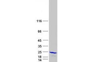 Validation with Western Blot