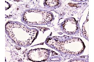 IHC analysis of Rad51 using anti-Rad51 antibody (ABIN6719396). (RAD51 anticorps)