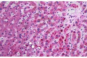 Human Liver: Formalin-Fixed, Paraffin-Embedded (FFPE) (APOC3 anticorps  (N-Term))