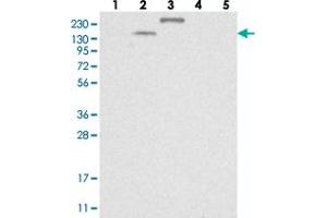 Western blot analysis of Lane 1: RT-4, Lane 2: U-251 MG, Lane 3: Human Plasma, Lane 4: Liver, Lane 5: Tonsil with TTC21B polyclonal antibody .