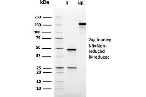 SDS-PAGE Analysis Purified ODC-1 Recombinant Mouse Monoclonal Antibody (rODC1/485).