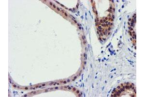 Immunohistochemical staining of paraffin-embedded Human breast tissue using anti-FBXO21 mouse monoclonal antibody.