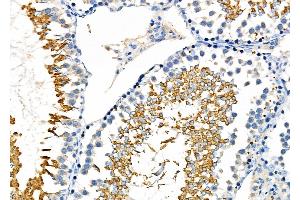 ABIN6262069 and ABIN6276964 at 1/100 staining Rat testis tissue by IHC-P. (GPX4 anticorps  (C-Term))