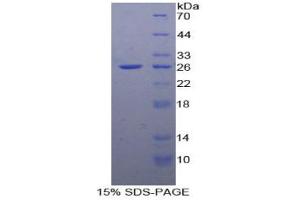 SDS-PAGE analysis of Human FADD Protein. (FADD Protéine)