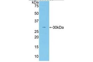 Rabbit Capture antibody from the kit in WB with Positive Control: Sample Human serum. (Coagulation Factor V Kit ELISA)