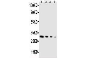 Lane 4: SMMC Cell Lysate