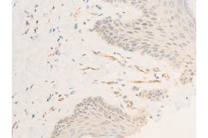 ABIN6267302 at 1/100 staining human skin tissue sections by IHC-P.