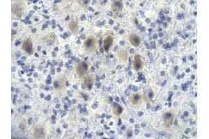 Rabbit Anti-NFKBIA antibody        Paraffin Embedded Tissue:  Human Brain cell   Cellular Data:  Epithelial cells of renal tubule  Antibody Concentration:   4. (NFKBIA anticorps  (N-Term))