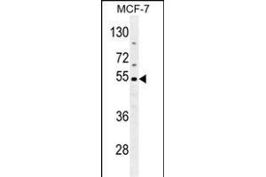 CES2 Antibody (Center) (ABIN654618 and ABIN2844316) western blot analysis in MCF-7 cell line lysates (35 μg/lane). (CES2 anticorps  (AA 340-369))