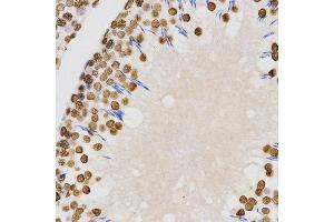 Immunohistochemistry (IHC) image for anti-Histone H4 (2meLys20) antibody (ABIN3016048)