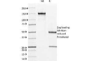 SDS-PAGE Analysis Purified CD171 Mouse Monoclonal Antibody (UJ127). (L1CAM anticorps)