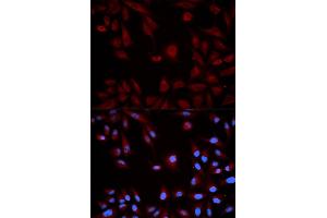 Immunofluorescence analysis of HeLa cells using STAT5B antibody. (STAT5B anticorps)