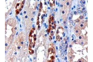 ABIN184784 (3µg/ml) staining of paraffin embedded Human Kidney. (CBR1 anticorps  (C-Term))