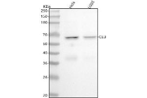 Western blot analysis of Clusterin using anti-Clusterin antibody (ABIN7604459).