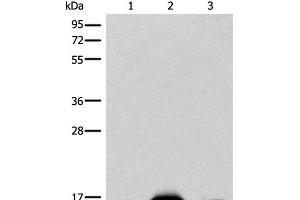 Western blot analysis of Mouse heart tissue Human heart tissue Human muscle tissue lysates using COX6A2 Polyclonal Antibody at dilution of 1:400 (COX6A2 anticorps)