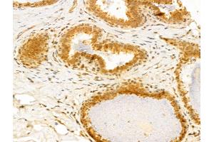 ABIN6259941 and ABIN6273031 at 1/100 staining Human normal tissues adjacent to breast cancer by IHC-P. (Annexin VII anticorps  (N-Term))