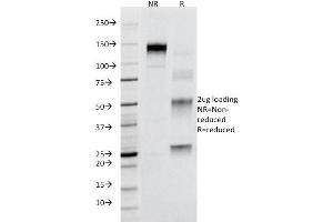 SDS-PAGE Analysis Purified CD95 Mouse Monoclonal Antibody (B-R18). (FAS anticorps)