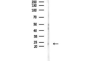 anti-Inosine Triphosphatase (ITPA) (Internal Region) antibody