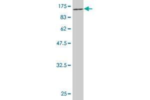 Western Blot detection against Immunogen (85. (CHEK2 anticorps  (AA 1-543))