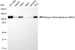 anti-Retinoblastoma Protein (Rb Protein) (pSer807) antibody