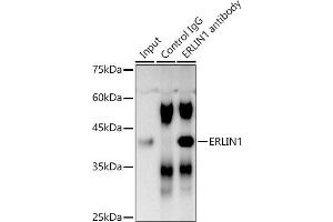 Immunoprecipitation analysis of 300 μg extracts of DU145 cells using 3 μg ERLIN1 antibody (ABIN7267005). (ERLIN1 anticorps  (AA 259-348))