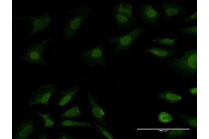 Immunofluorescence of purified MaxPab antibody to PSMB7 on HeLa cell. (PSMB7 anticorps  (AA 1-277))