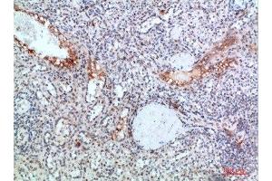 Immunohistochemical analysis of paraffin-embedded human-spleen, antibody was diluted at 1:200 (TICAM1 anticorps  (AA 663-712))