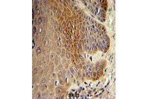 COL17A1 Antibody (Center) IHC analysis in formalin fixed and paraffin embedded skin tissue followed by peroxidase conjugation of the secondary antibody and DAB staining.