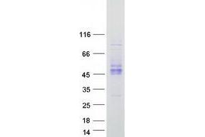Validation with Western Blot