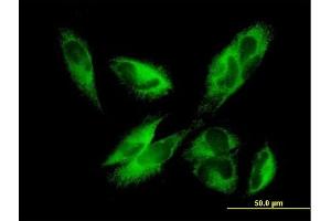 Immunofluorescence of purified MaxPab antibody to EPHX1 on HepG2 cell. (EPHX1 anticorps  (AA 1-455))
