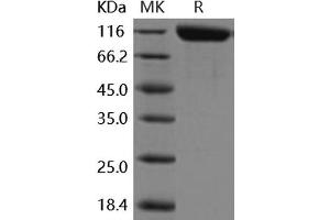 Western Blotting (WB) image for Alanyl (Membrane) Aminopeptidase (ANPEP) (Active) protein (His tag) (ABIN7194190)