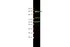 Western blot using  affinity purified anti-FANCA antibody shows detection of a band at ~133 kDa (arrowhead) corres-ponding to FANCA in HeLa whole cell lysates.