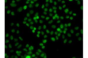 Immunofluorescence analysis of A549 cells using PIP5K1A antibody (ABIN5975757). (PIP5K1A anticorps)