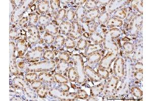IHC analysis of CBR1 using anti-CBR1 antibody (ABIN7600015). (CBR1 anticorps  (AA 14-262))