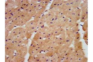 IHC image of ABIN7151025 diluted at 1:600 and staining in paraffin-embedded human heart tissue performed on a Leica BondTM system.