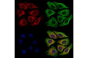 ABIN6263380 and ABIN6279011 staining Hela cells by IF/ICC. (MRPS26 anticorps  (Internal Region))
