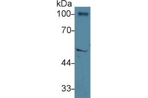 Detection of PPARg in Rat Cerebrum lysate using Polyclonal Antibody to Peroxisome Proliferator Activated Receptor Gamma (PPARg)