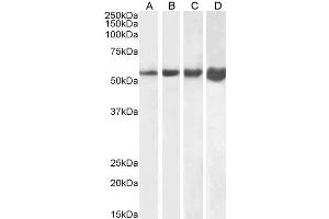 ABIN334386 (1µg/ml) staining of Human (A), Mouse (B), Rat (C) and Pig (D) Skeletal Muscle lysate (35µg protein in RIPA buffer).