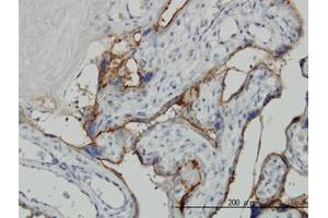Image no. 1 for anti-Alkaline Phosphatase, Placental-Like 2 (ALPPL2) (AA 365-455) antibody (ABIN769091) (ALPPL2 anticorps  (AA 365-455))