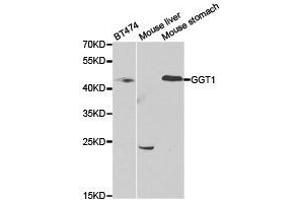 Western Blotting (WB) image for anti-gamma Glutamyltransferase 1 (GGT1) antibody (ABIN1872809) (GGT1 anticorps)