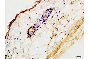 Formalin-fixed and paraffin embedded rat skin tissue labeled with Anti-CK2 Polyclonal Antibody,Unconjugated  at 1:200 followed by conjugation to the secondary antibody and DAB staining