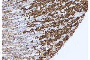 ABIN6277575 at 1/100 staining Human gastric tissue by IHC-P. (PCCB anticorps  (Internal Region))