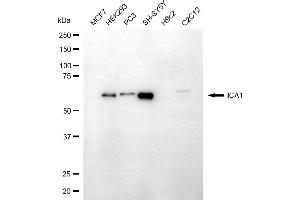 anti-Islet Cell Autoantigen 1, 69kDa (ICA1) antibody