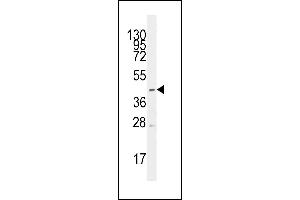 Western blot analysis of anti-SLC16A1 Antibody (Center) (ABIN389231 and ABIN2839383) in CEM cell line lysates (35 μg/lane).