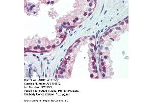 Human Prostate (NRF1 anticorps  (Middle Region))