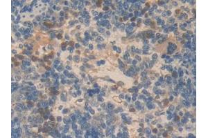 DAB staining on IHC-P; Samples: Rat Spleen Tissue
