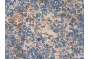 DAB staining on IHC-P; Samples: Rat Spleen Tissue (SMAD6 anticorps  (AA 171-441))