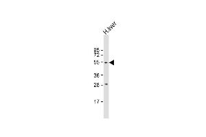 Anti-ANGPT2 Antibody (C-term) at 1:2000 dilution + human liver lysate Lysates/proteins at 20 μg per lane.
