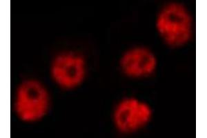 ABIN6267669 staining K562 by IF/ICC.